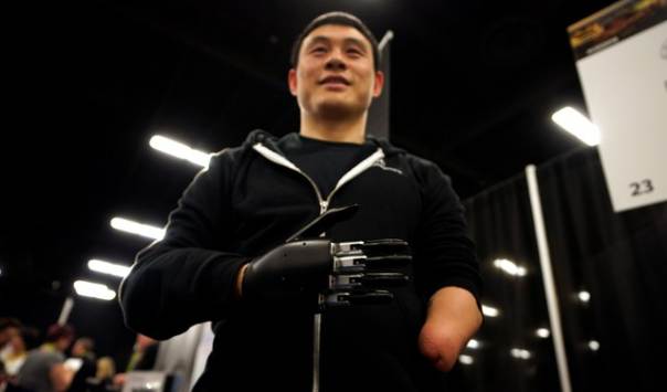 A patient wearing the Brain Robotics prosthetic arm featured at CES 2019. 
