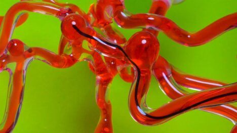 MIT's new robotic wire seamlessly moves through sensitive blood vessels.